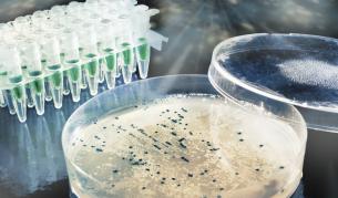 Най-голямото изчезване на видове е било заради микроби