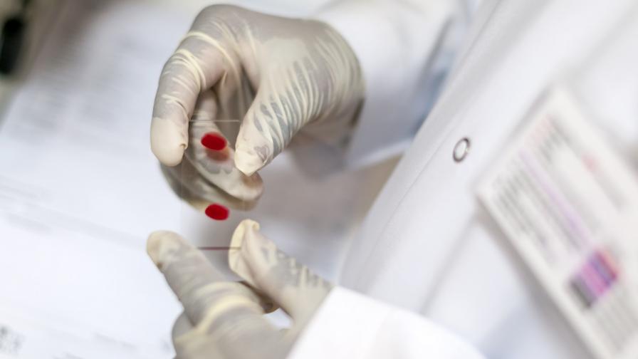 Учен: До една година ще има лек за Хепатит С