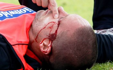 Разкървавена глава стресна националите на Англия