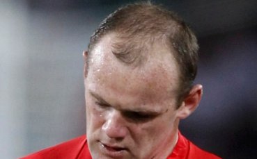 На Рууни му пада косата, на Колийн й расте
