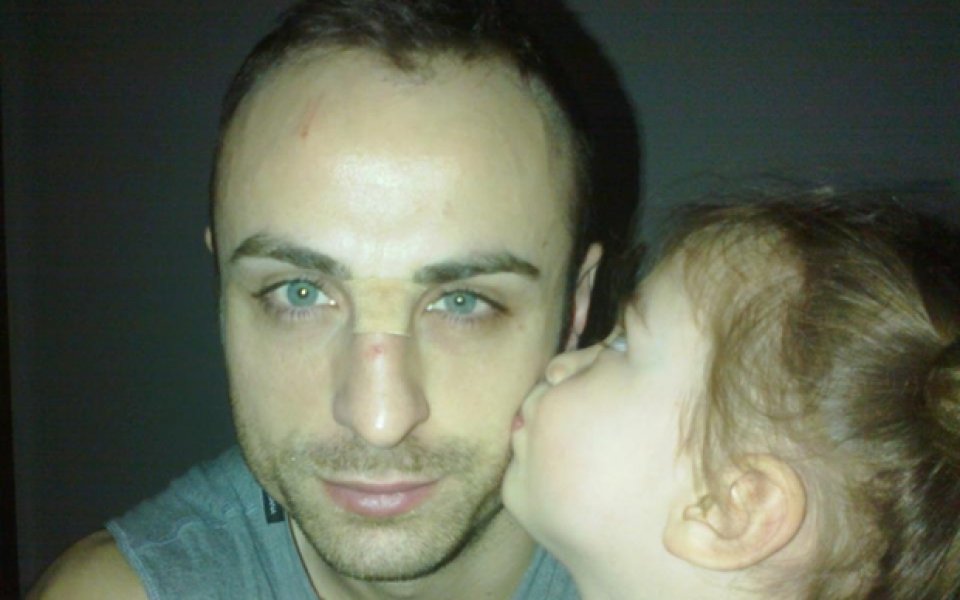 СНИМКА: Бербатов се лекува с целувки