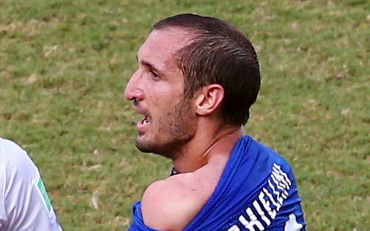 Доказателството: Ухапаното рамо на Киелини