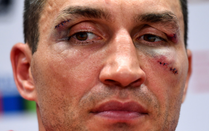 Кличко: Мачът с Фюри ще е най-важният в кариерата ми