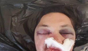 Задържаха двама за побоя на журналист в Поморие