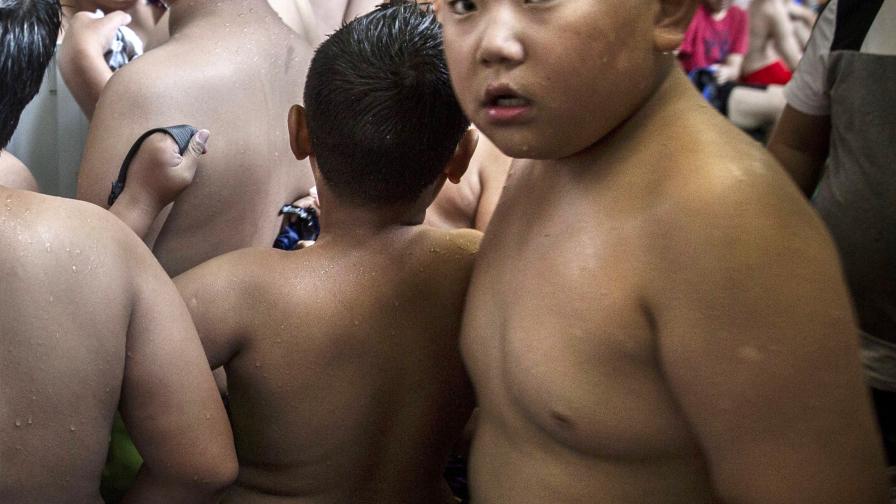 Най-дебелото дете на крачка от смъртта - тежи 192 кг