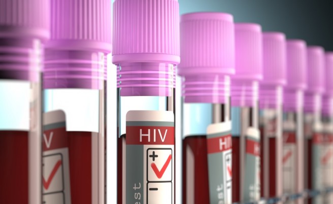  СПИН: Източна Европа е по-зле от Африка 