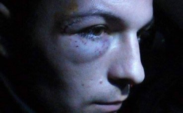 След побой при юношите, Велбъжд съди играч на Септември