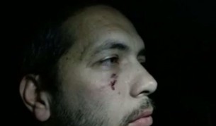 Пострадалият оператор Огнян Пенев