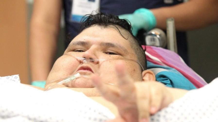 Хирурзи изрязаха частично стомаха на най-дебелия мъж в света