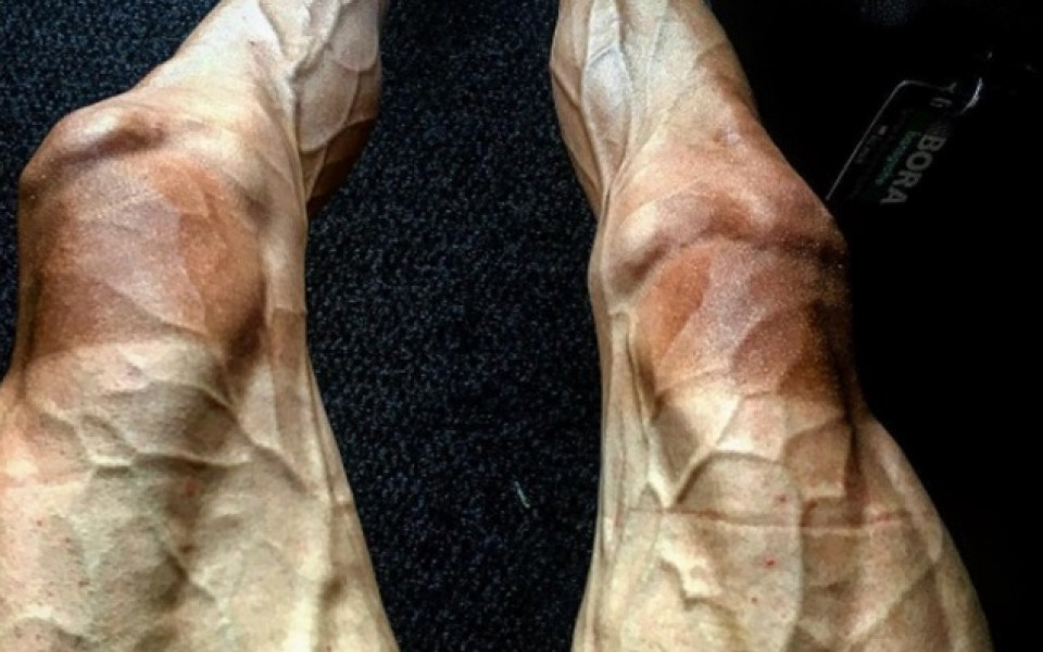 Полски колоездач разбуни духовете със снимка на краката си