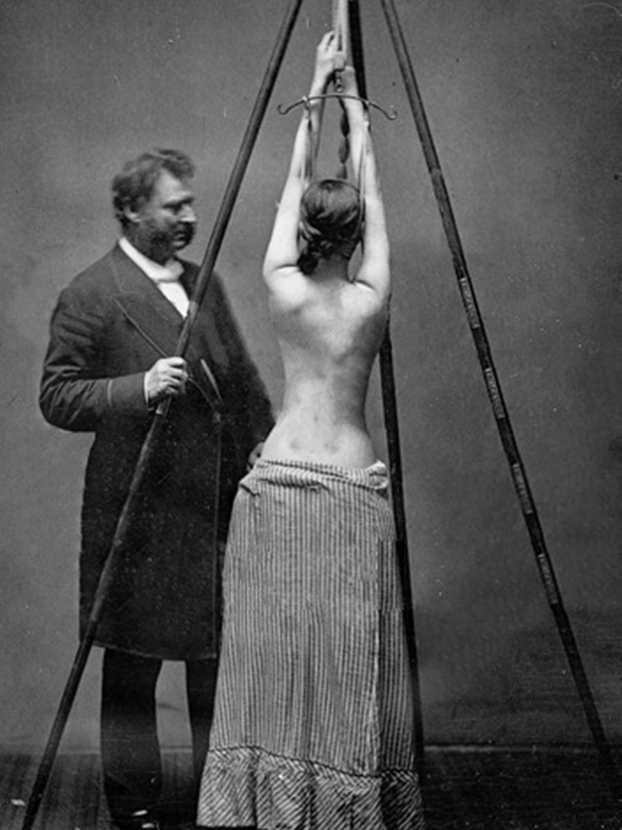 Въпреки че снимката изглежда като кадър от началото на садомазохистичен филм, всъщност това е нагледен пример как са се провеждали изследванията на един от най-добрите американски ортопеди и хирурзи д-р Луис Сайр.