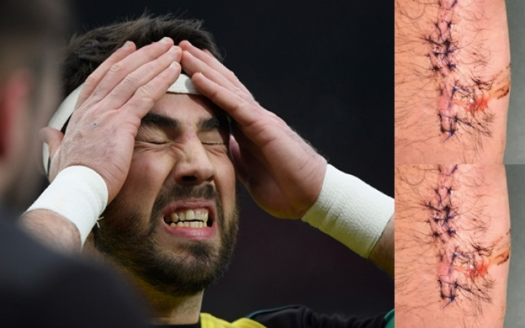 Ръгбист за малко да загуби ръката си, ухапа го лъв