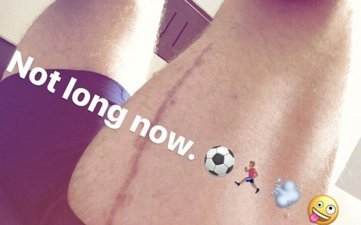 Рос Баркли показа 25-сантиметров белег