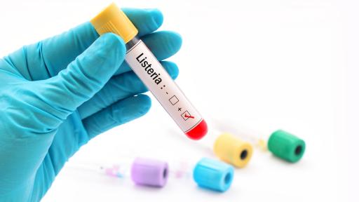  <p>Опасна <strong>епидемия</strong> в Испания</p> 