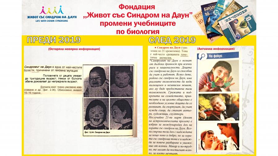  „ Живот със Синдром на Даун “ провокира смяна в учебниците по биология 