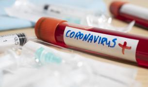 Осем нови случая на заразени с COVID-19 у нас, 14 души са изписани до момента Осем нови случая на заразени с COVID-19 у нас, 14 души са изписани до момента