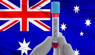 Заразните с коронавируса вероятно са 5-10 милиона, смята главният лекар на Австралия