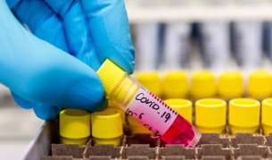 Ново огнище: 12 деца от дом във Видин с COVID-19