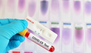 Новите потвърдени случаи на коронавирус са 32, огнище в Смолян