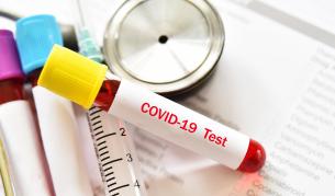 Отново антирекорд - нови 330 случая на коронавирус, осем починали