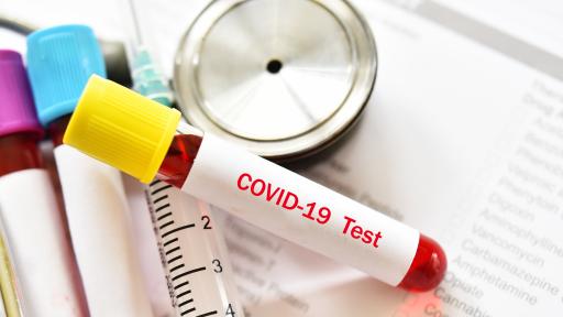  Отново растеж на инфектираните с ковид, още шестима умряли 