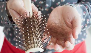 <p>Защо COVID-19 може да причини и косопад</p>