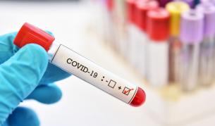 COVID-19: 3475 нови случаи при 9 056 PCR теста