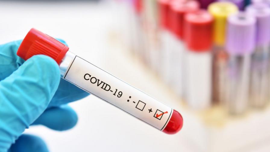 COVID-19: 3475 нови случаи при 9 056 PCR теста