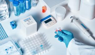 COVID-19: 1739 нови случаи при направени 6190 PCR теста