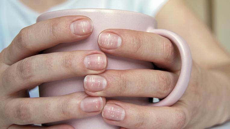  Какво споделят ноктите за здравето ти 