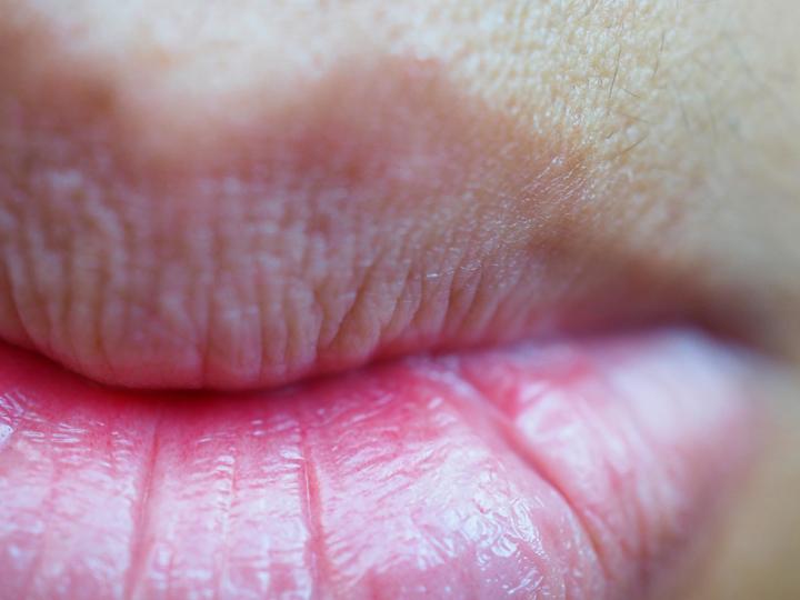 <p><strong>Бледи устни</strong></p>

<p>Ако устните ви са се превърнали от типичното розово в бледо розово, това може да означава недостиг на витамини или дори рак на кожата. Внезапната поява на бледност може да е признак на желязодефицитна анемия. При всички положения, промяната в цвета на устните трябва да се обсъди с вашия лекар.</p>