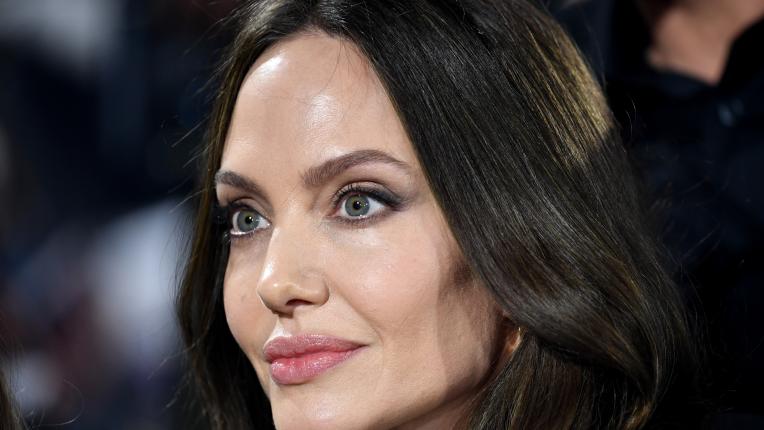 Специалистите предполагат: ето какви пластични корекции има Анджелина Джоли