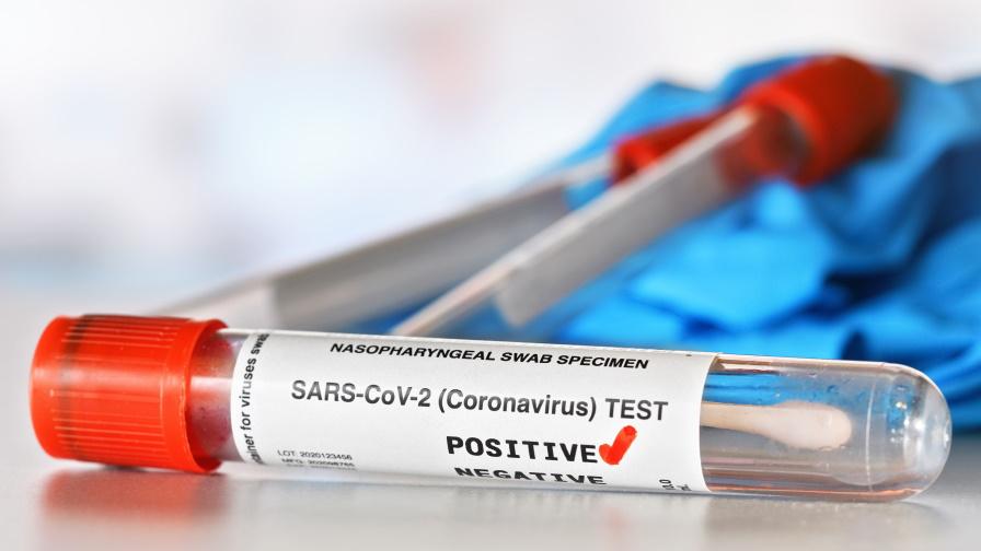 Коронавирусът: 14% от пробите са положителни