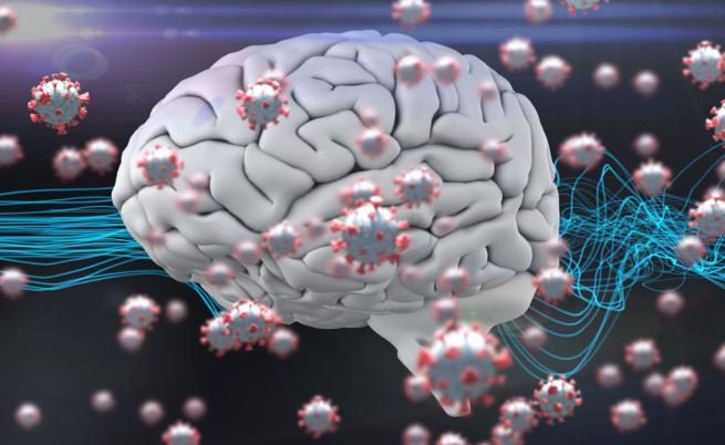 Проучване: Тежкият COVID-19 причинява промени в мозъка, подобни на Алцхаймер