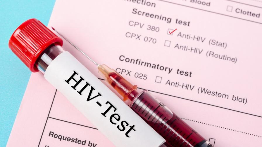 Франция ще приема ХИВ-позитивни в армията