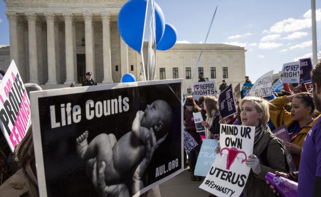 АНКЕТА: Одобрявате ли по-строги закони за абортите?