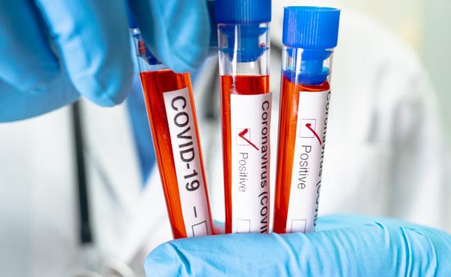 На фона на растящия брой случаи на COVID-19: ЕК призова за ваксинация