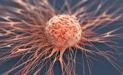 Пробив в медицината: Учени откриха възможност за ранно диагностициране на рака