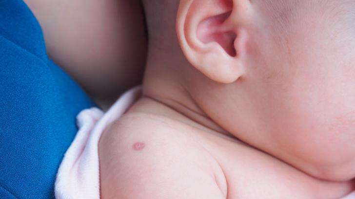 За бебе на 7 месеца: Проверка на белег след БЦЖ ваксина (СНИМКА)