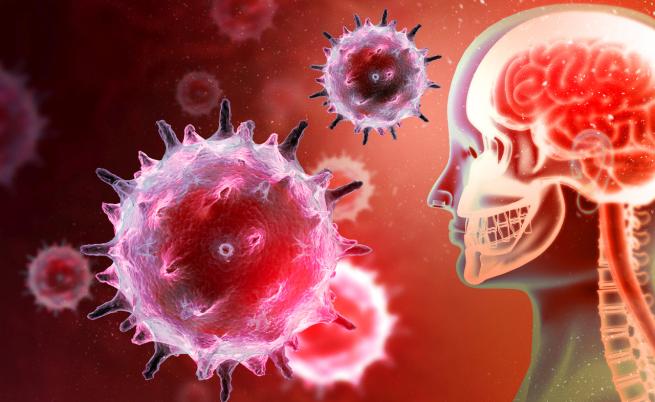 Смъртоносният бактериален менингит – ето какви са симптомите и рисковете
