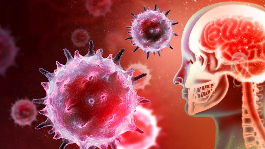 Смъртоносният бактериален менингит – ето какви са симптомите и рисковете
