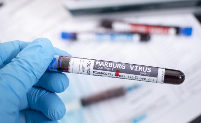 Танзания обяви огнище на смъртоносния вирус Марбург, СЗО с препоръки