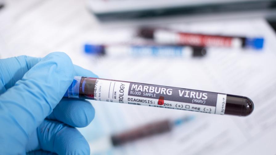 <p>Мистериозна&nbsp;болест, подобна на Ебола: Вирусът Марбург с ново огнище</p>
