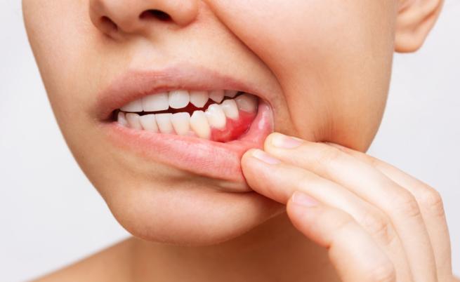 Непозната и шокираща – какво знаем за историята на стоматологията