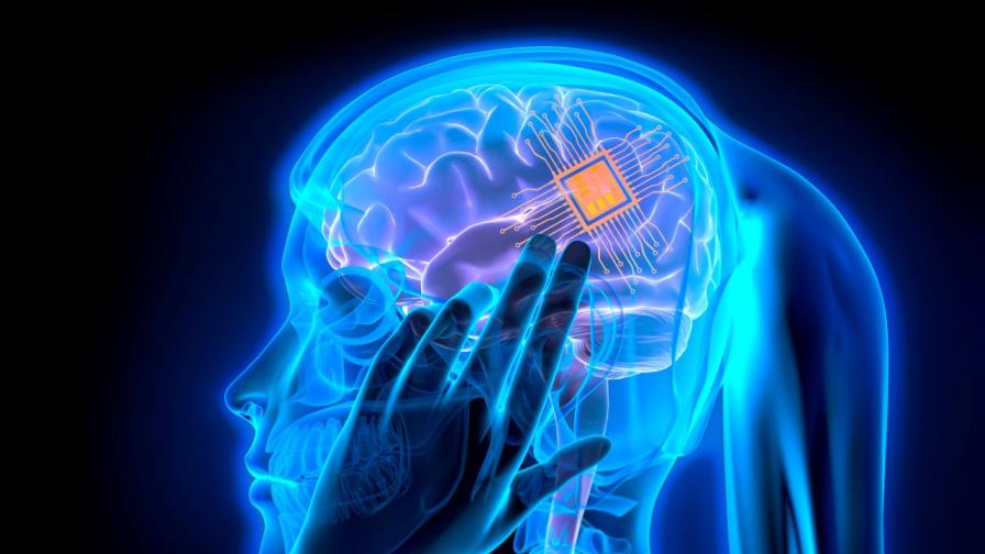 От мисъл към реч: Учени тестват революционен мозъчен имплант