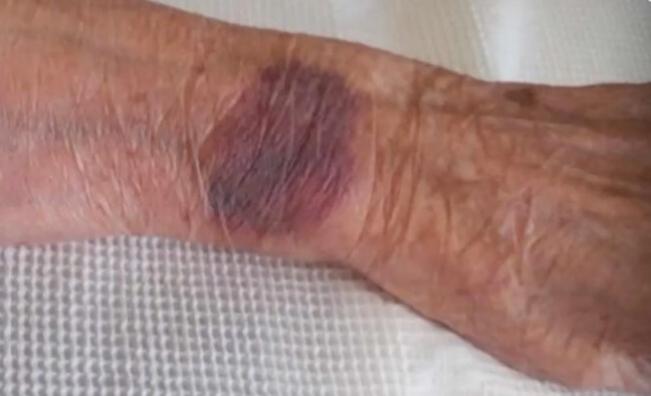 Връзвали 104-годишна жена в болница във Видин