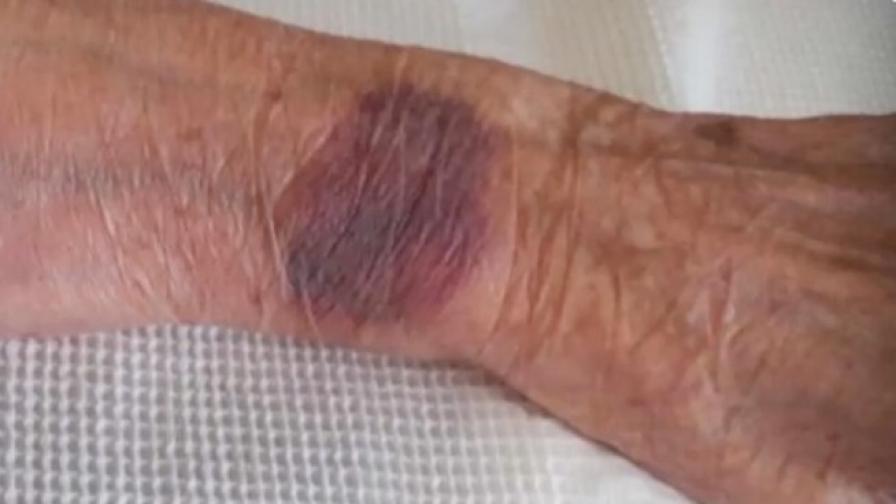 Връзвали 104-годишна жена в болница във Видин