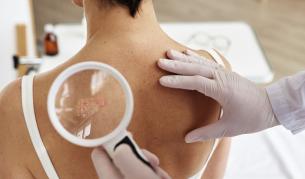 <p>Неприятното заболяване атакува богатите региони</p>