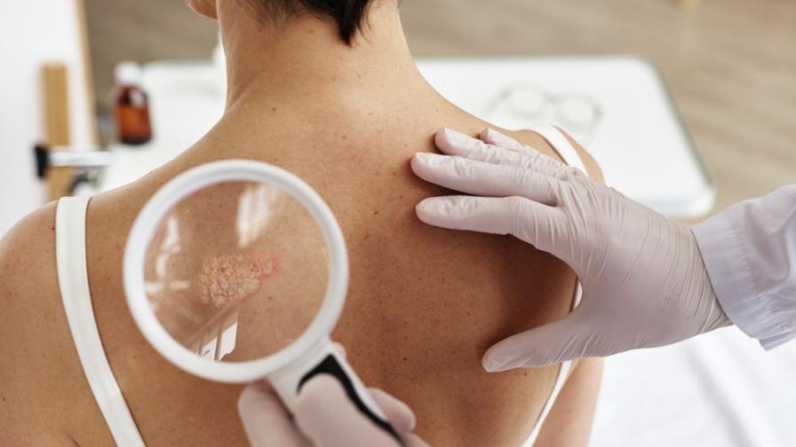 <p>Неприятното заболяване атакува богатите региони</p>