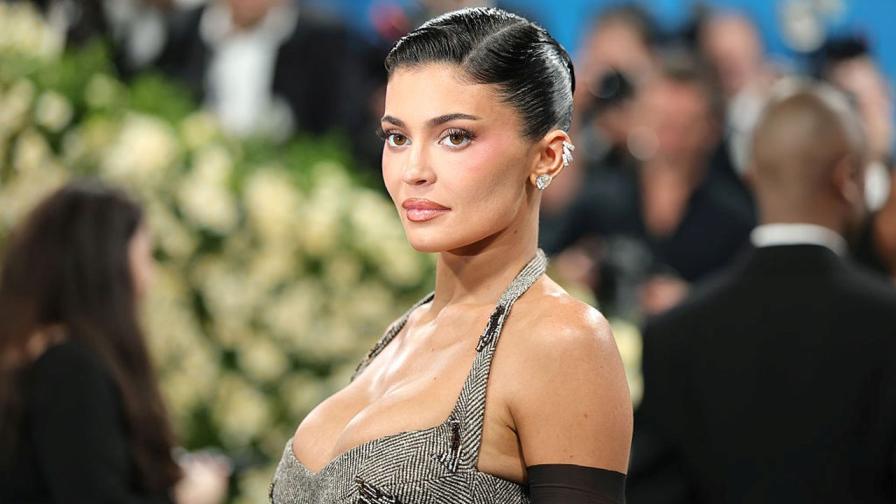 Кайли Дженър е преминала терапия със стволови клетки за хронична болка в гърба